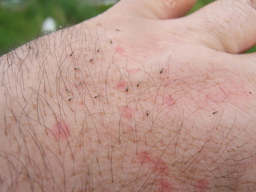 Midgies op een hand