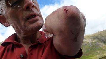 Humpty Dumpty had a great fall